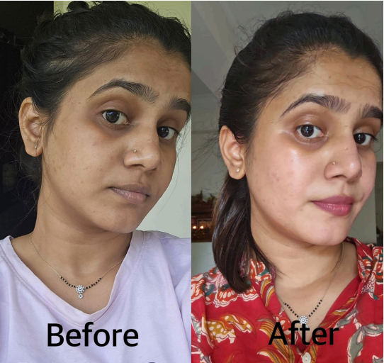 medi facial in mangalore