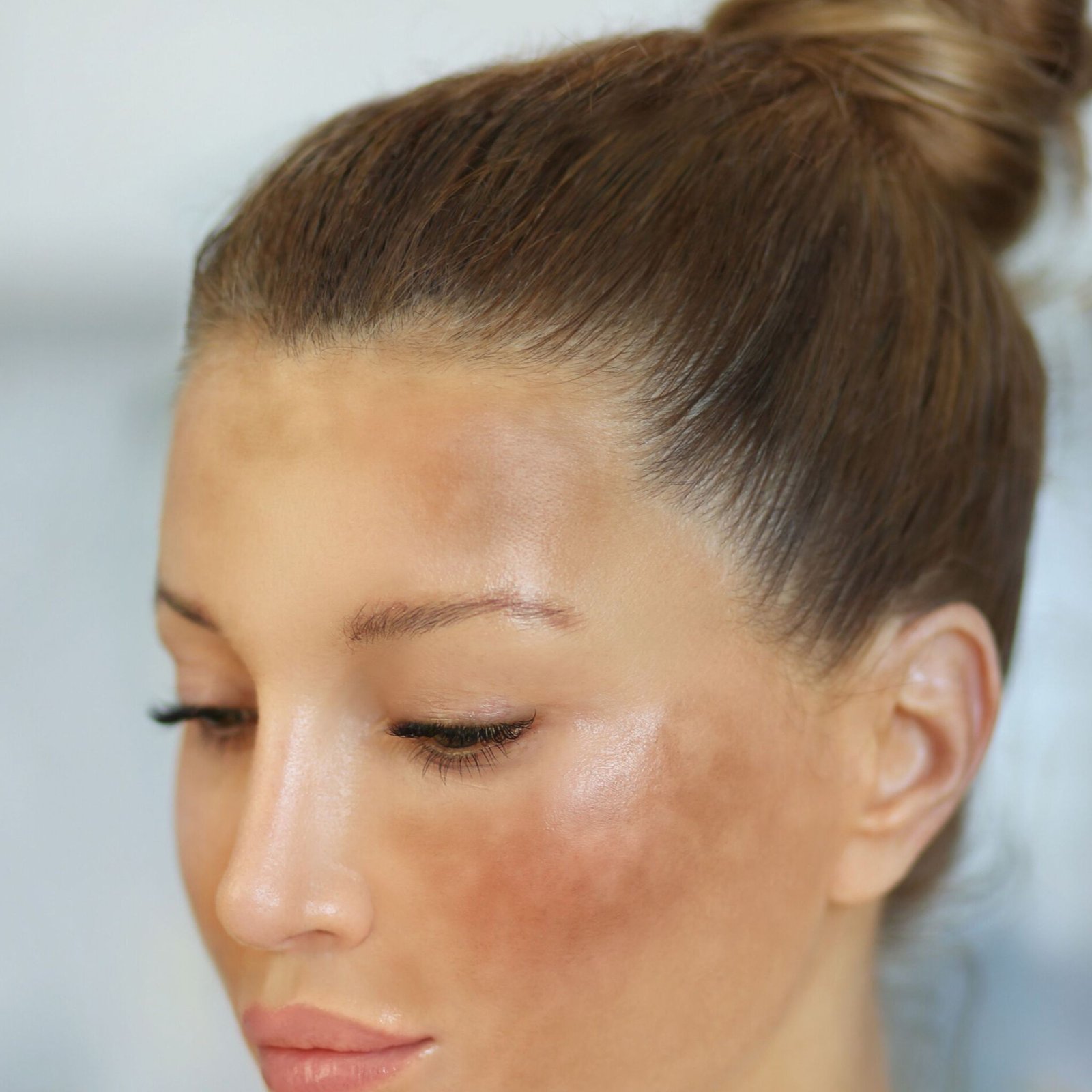 Dark spots